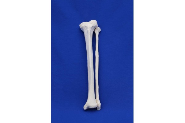 TIBIA AND FIBULA SOLID FOAM RIGHT