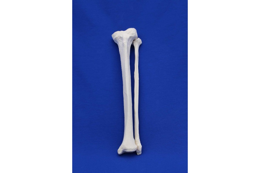 TIBIA AND FIBULA SOLID FOAM RIGHT