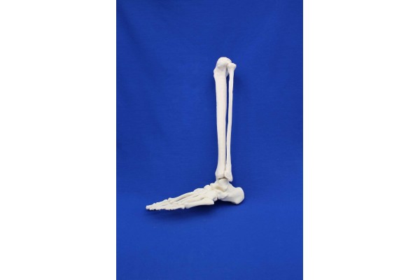 FOOT TIBIA AND FIBULA SOLID FOAM