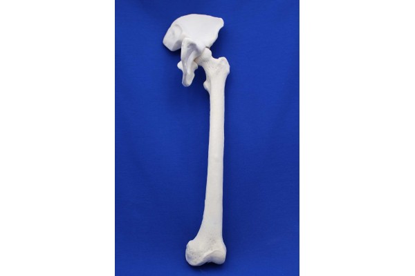 FOOT-ILIAC CRST SOLID FOAM RIGHT