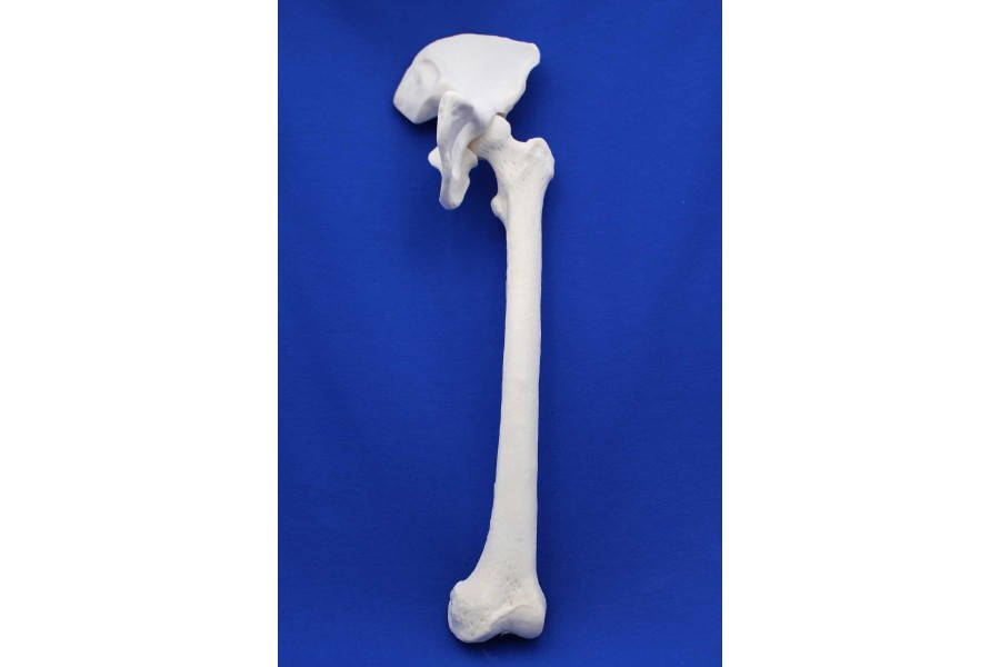 FOOT-ILIAC CRST SOLID FOAM RIGHT