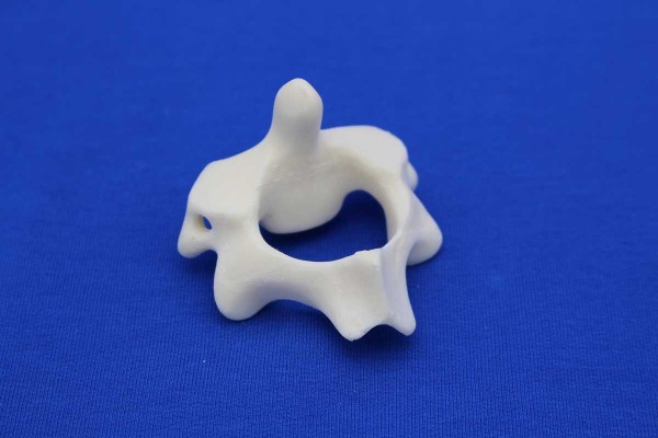 VERTEBRA C2 SOLID FAOM