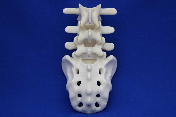 Rachis L3/Sacrum Solid Foam