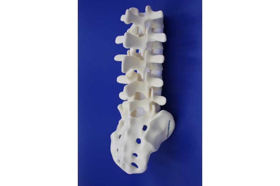 SPINE L1/SACRUM SOLID FOAM