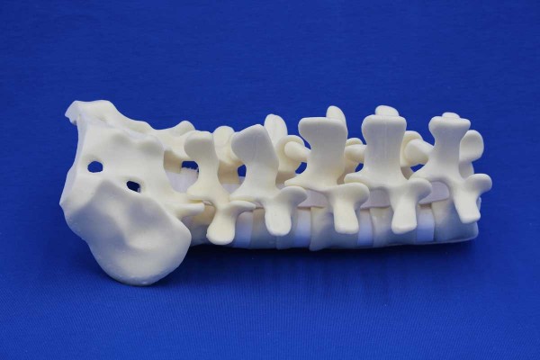 SPINE L1/HALF SACRUM SOLID FOAM