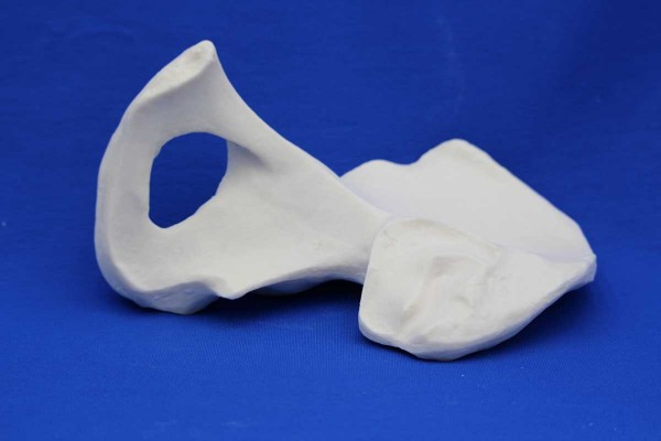 Hemi Pelvis Solid Foam