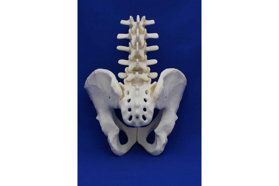 L1/SACRUM WITH PELVIS SOLID FOAM