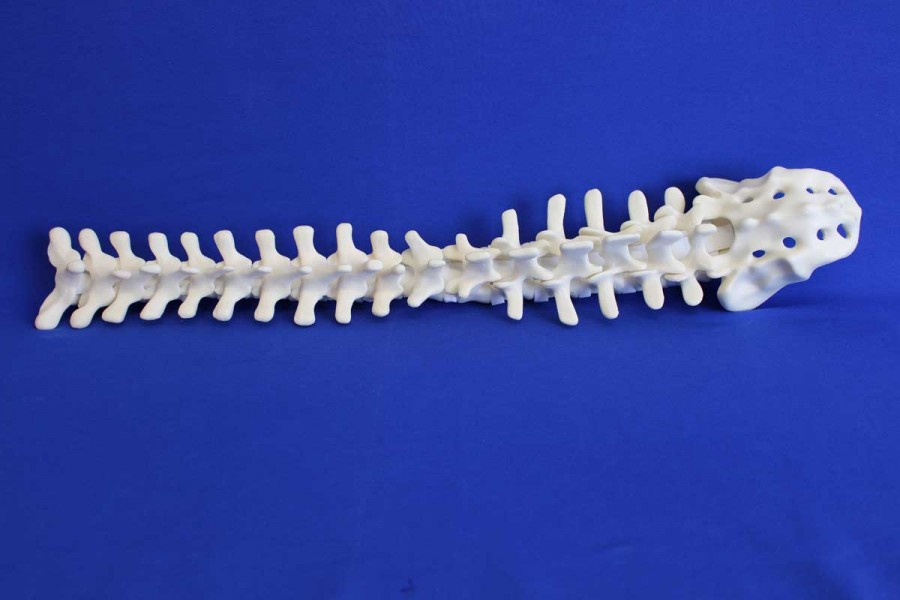 SPINE T1/SACRUM SOLID FOAM