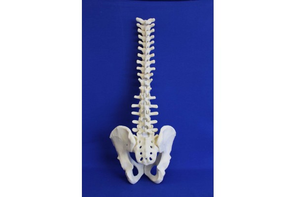 SPINE T1/SACRUM AND PELVIS SOLID FOAM