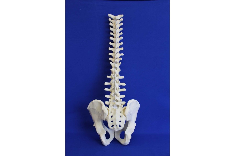 SPINE T1/SACRUM AND PELVIS SOLID FOAM