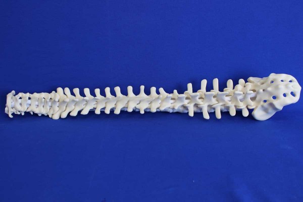 SPINE C1/SACRUM SOLID FOAM