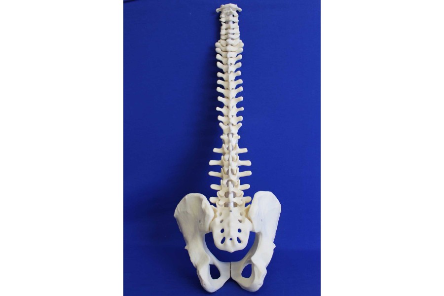 SPINE C1/SACRUM AND PELVIS SOLID FOAM