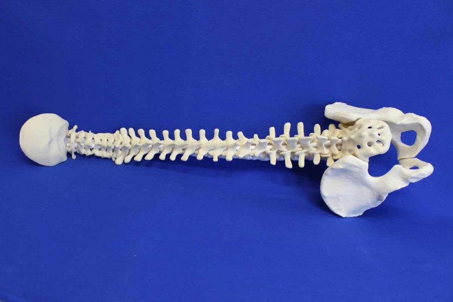 SPINE OCCIPUT /SACRUM AND PELVIS SOLID FOAM