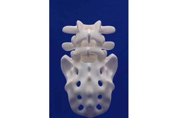 Rachis L4/Sacrum White Resin