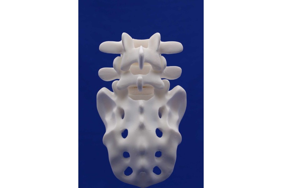 Rachis L4/Sacrum White Resin