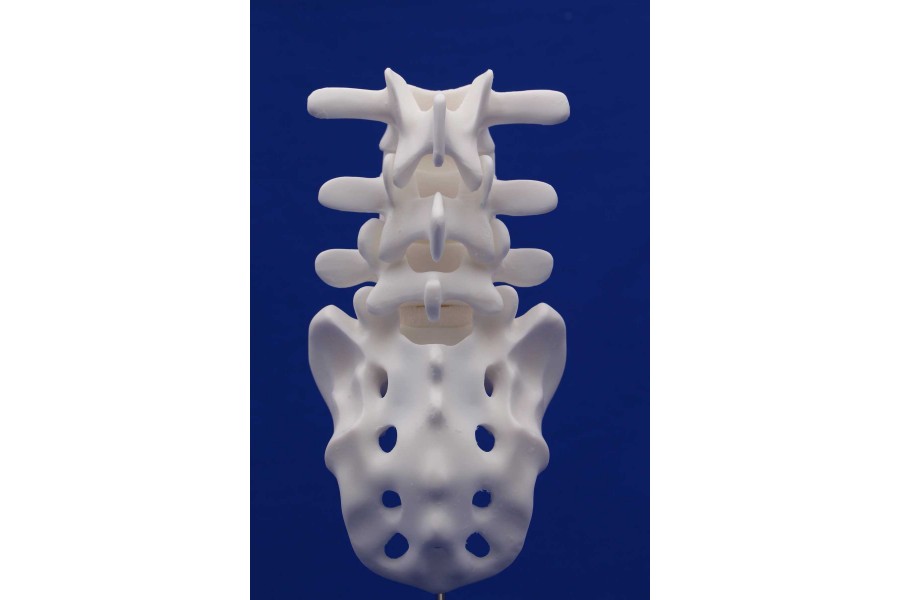 SPINE L3/SACRUM WHITE RESIN