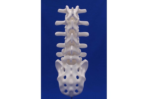 SPINE L1/SACRUM WHITE RESIN