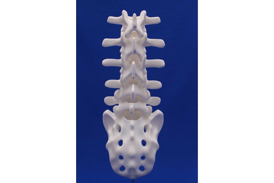 SPINE L1/SACRUM WHITE RESIN