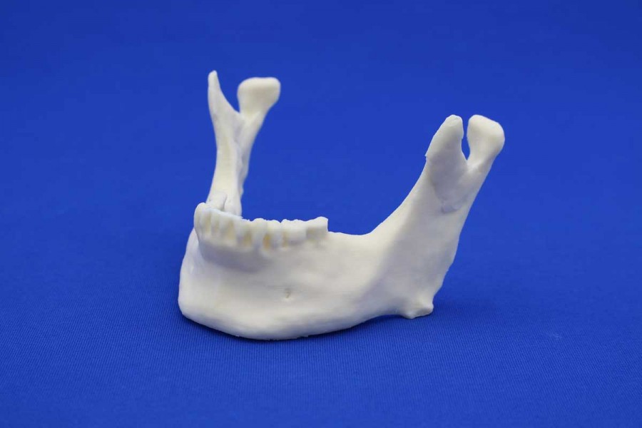 Mandibule Solid Foam