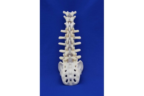 SPINE T10/SACRUM SOLID FOAM