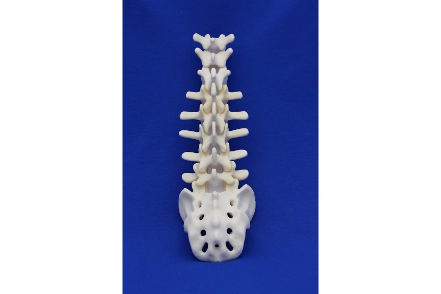 SPINE T10/SACRUM SOLID FOAM