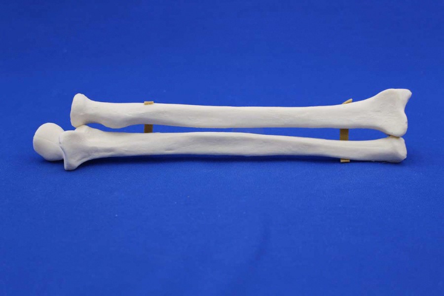 Radius et Ulna Solid Foam